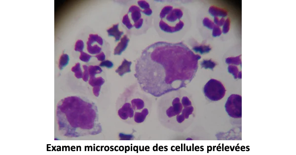 Examen microscopique des cellules prélevées