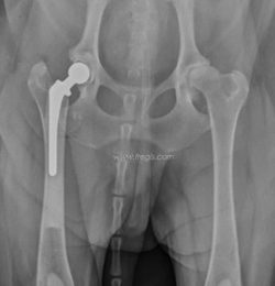 A gauche : Prothèses non cimentées posées sur un jeune chien atteint d’anomalies sévères des deux hanches