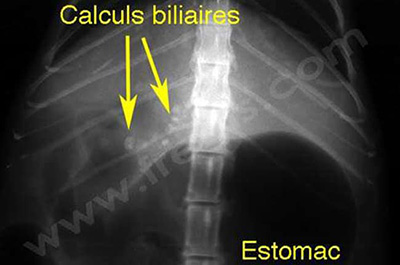 radiographie chat avec de nombreux calculs dans les voies biliaires