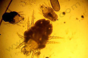 Cheyletielles avec nymphe et œuf au microscope (x10)