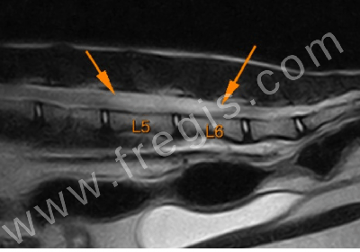 IRM montrant un gliome intramédullaire sur un chat (coupe sagittale)