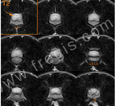 IRM montrant un gliome intramédullaire sur un chat (coupe transverse)
