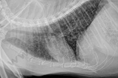 Radiographie thoracique latérale montrant des anomalies bronchiques et péribronchiques importantes