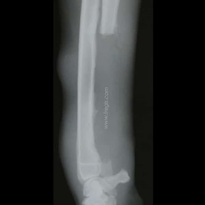 Chondrosarcome du chien : radiographie du même chien que la photo 2, 3 semaines après la chirurgie