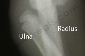 Chien de race Yorkshire terrier présentant une luxation congénitale du coude de type 1. Radiographie de face du coude