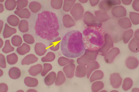 Inclusion virale dans un globule blanc de chien, compatible avec une maladie de Carré (© laboratoire Vebio)