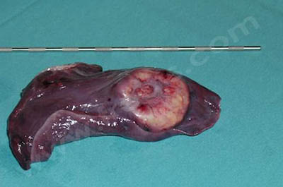 Tumeur pulmonaire extraite par thoracoscopie chez un chien (technique mini-invasive)