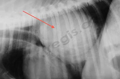 Radiographie du thorax chez un chien Boxer. Une volumineuse tumeur pulmonaire est mise en évidence
