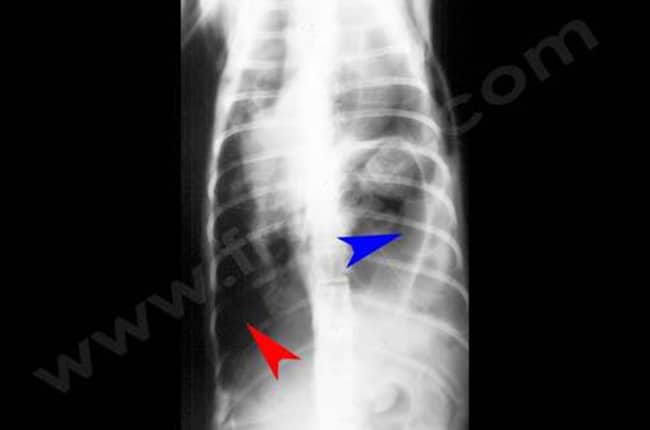 Radiographie du thorax, chat, accident de la rue