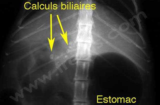 Radiographie chat présentant de nombreux calculs dans les voies biliaires