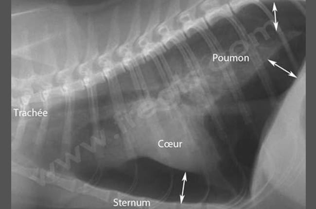 Radiographie du thorax d’un chat tombé du 7ème étage (souvent appelé « chat parachutiste »).