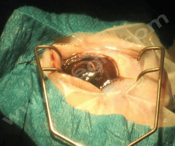 Chirurgie de Cataracte chez un lapin - CHV Fregis