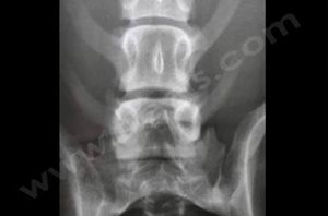 2. Radiographie de Spina bifida chez un chien​
