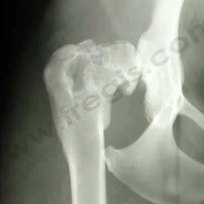Radiographie des hanches d'un chien adulte, totalement remodelées par de l'arthrose ce qui leur donne un aspect en champignon