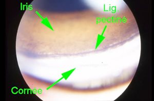 1. Examen de l’angle irodo-cornéen au travers d’une lentille de gonioscopie chez un chien Fox-Terrier. La structure visible de l’angle est le ligament pectiné, il est ici étroit et mal ouvert. Le chien est donc prédisposé au glaucome.