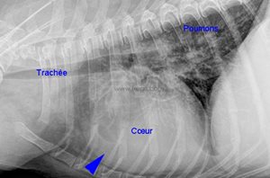 2. Radiographie des poumons d’un chien Westy (WHWT) de 11 ans présenté pour syncope. On observe des augmentations anormales de la densité des poumons et une augmentation de la partie droite du cœur (flèche bleue). Ces observations sont compatibles avec l’évolution d’une fibrose pulmonaire