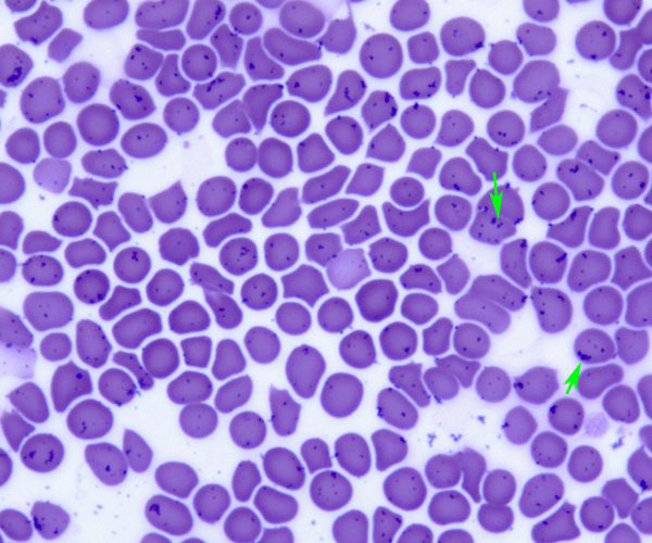 Globules rouges d’un chat infesté par Mycoplasma haemofelis (Hémobartonellose féline)