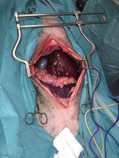 Grosse tumeur du foie chez un chien au niveau de la partie gauche du foie