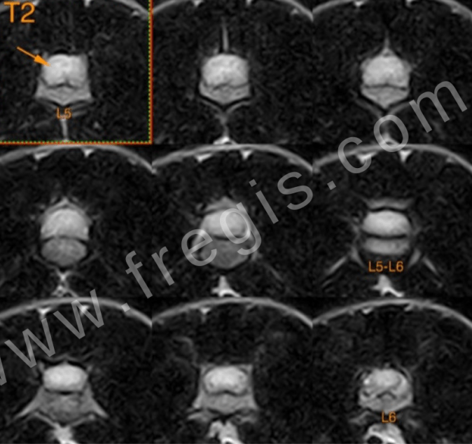 IRM montrant un gliome cérébral sur un labrador de 4 ans présenté pour crises convulsives (T2)