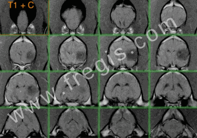 IRM montrant un gliome cérébral sur un labrador de 4 ans présenté pour crises convulsives (T1 post contraste)