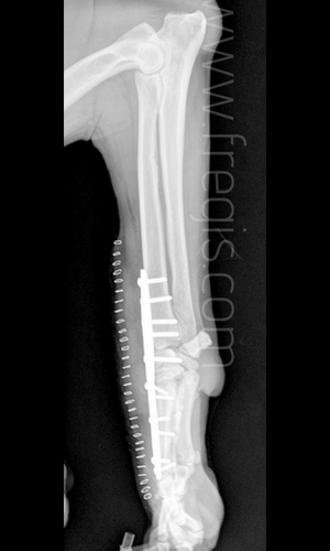 Radiographie après mise en place de la plaque d’ostéosynthèse lors d’arthrodèse du carpe chez un chien atteint d’un syndrome d’hyperextension du carpe