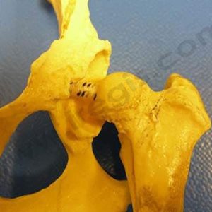 1. Modèle plastique d'une hanche de chien dysplasique. La cavité du bassin et la tête du fémur s'articulent mal et sont déformées par l'arthrose