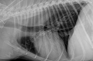 1. Ici une radiographie du thorax montrant la présence d’un mégaoesophage