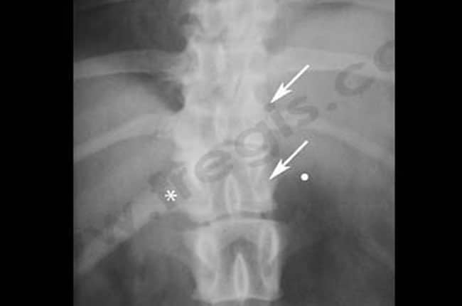 Radiographie de face de la colonne vertébrale d’un chien présentant une malformation de plusieurs vertèbres thoraciques.
