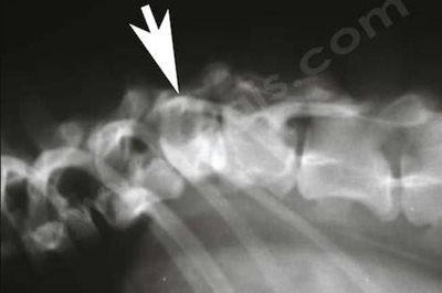 Radiographie de profil de la colonne vertébrale d’un chien présentant une malformation d’une vertèbre thoracique (hémivertèbre)