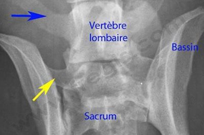 Radiographie du bassin d’un chien de race Labrador présentant une vertèbre lombo-sacrée transitionnelle.