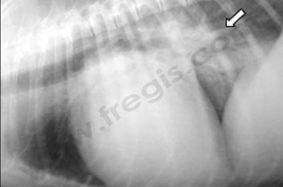 Radiographie du thorax d’un chien atteint d’une endocardiose avancée