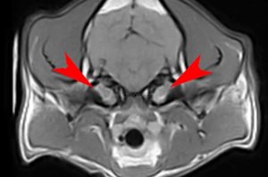 Résonance magnétique (IRM) d’un chien Cavalier King Charles présentant une otite bilatérale (flèches) responsable de troubles nerveux