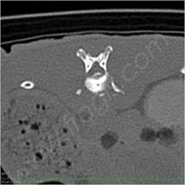 Scanner vertébral de lapin, visualisation d’une hernie discale non détectée à la radiographie responsable d’une paralysie - CHV Fregis