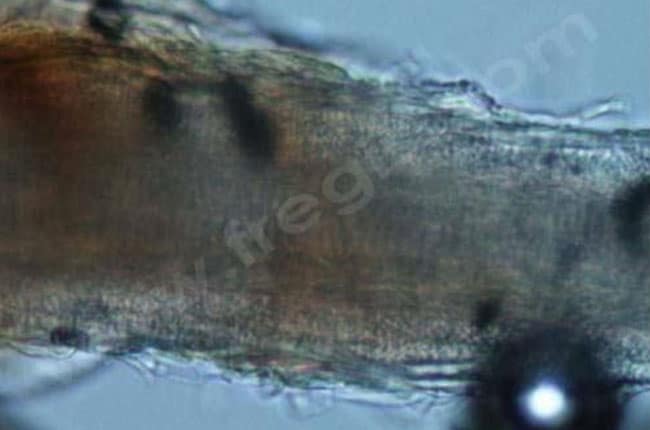 eigne chez le chien : Poil atteint avec des centaines de spores fongiques (examen microscopique, X400).
