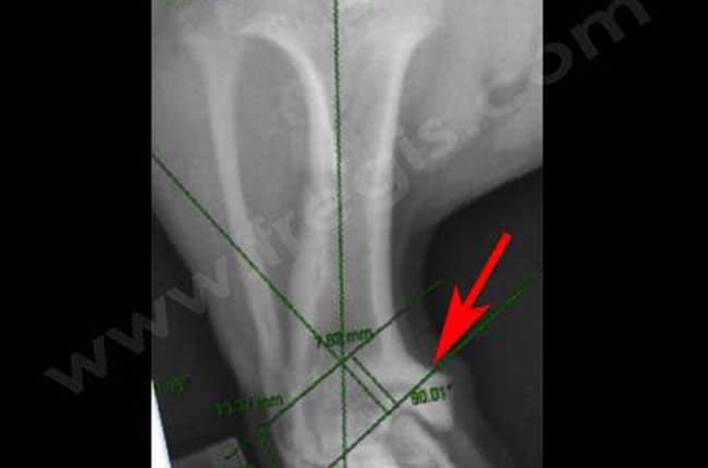 Radiographie du tibia droit du même chien. Le pes varus se manifeste par une déviation anormale du pied et une angulation de l’extrémité basse du tibia