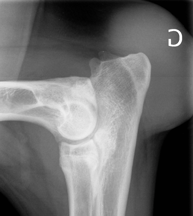 Radiographie de thorax en décubitus latéral droit