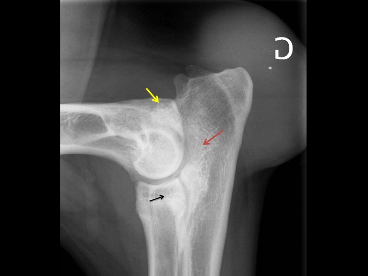 Figure 2 : Radiographie de thorax en décubitus ventro-dorsal