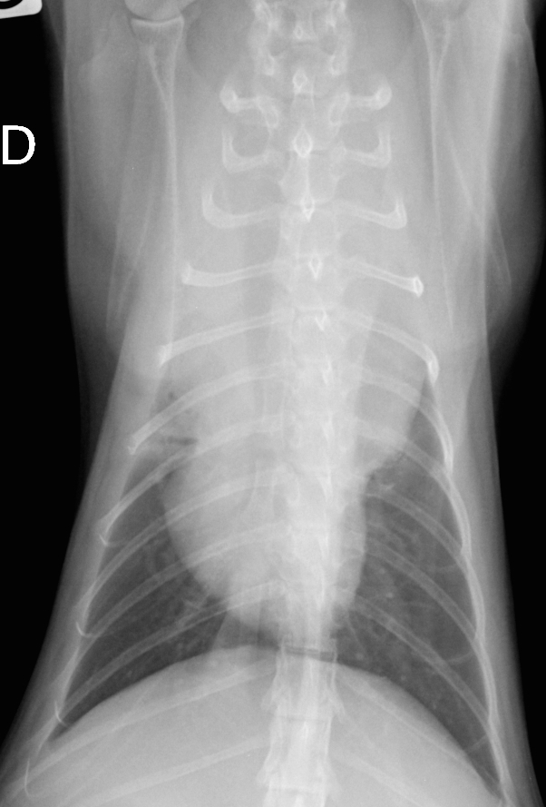 Radiographie de thorax en décubitus latéral droit