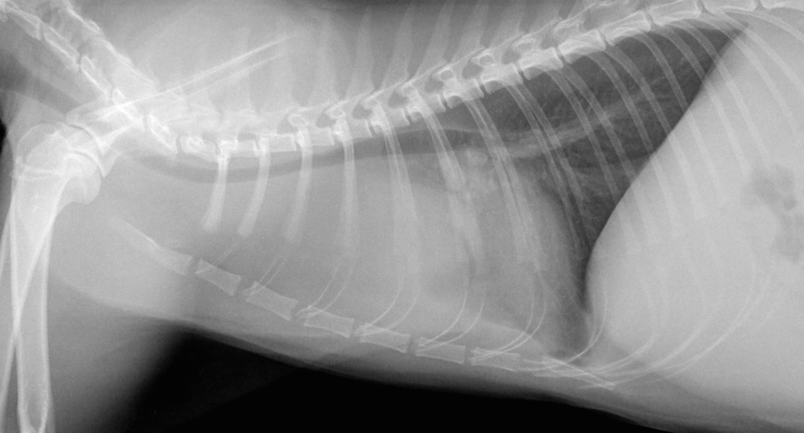 Figure 2 : Radiographie de thorax en décubitus ventro-dorsal