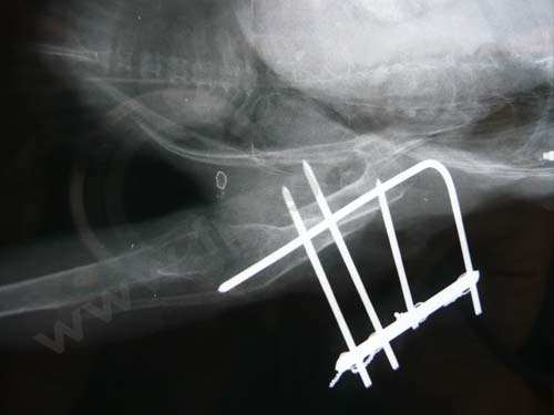 radiographie post op fracture perroquet
