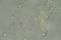 3. Cristaux d’oxalate de calcium dans les urines d’un chat intoxiqué par de l’antigel (ethylene glycol) (photo laboratoire Vebio)​