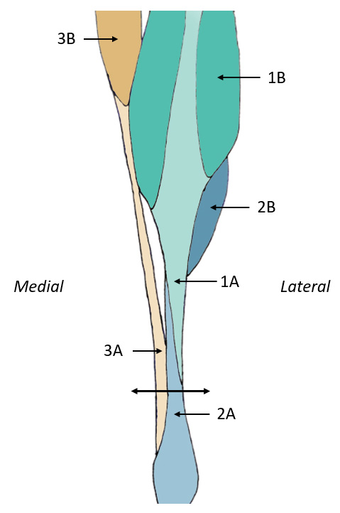 Figure 1 : photographieschématisation (à droite) en vue caudale des différents composants du tendon calcanéen commun après retrait de la gaine du tendon