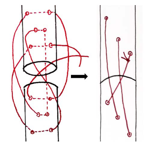 Figure 4 : Schématisation de la réalisation d’un triple nœud de poulie (à gauche en rouge)