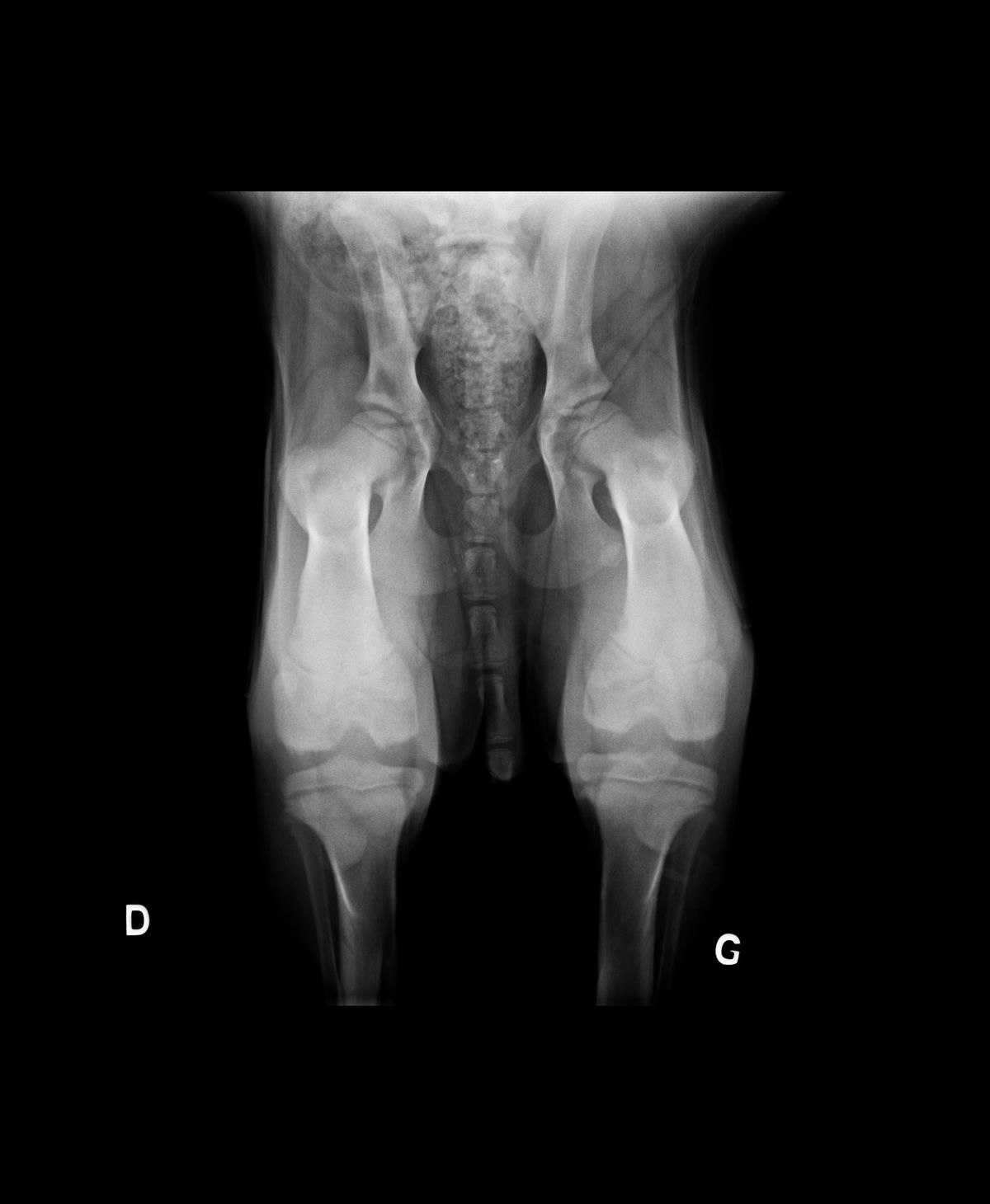 Radiograpie de dépistage précoce de dysplasie en compression (décubitus dorsal, hanches à environ 110° et grassets à 90°, compression latéro-médiale sur les hanches)