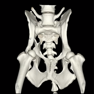 Fracture de la colonne ventrale avec extension au bord dorsal du cotyle chez un chien, reconstruction scanner 3D VR pré-opératoire