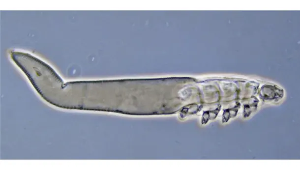 Demodex folliculorum © Mary Evans / Natural History Museum