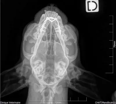 Radiographie : Ostéosynthèse de la machoire