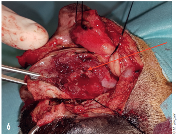 Carcinome Epidermoide De L Extremite Rostrale Du Septum Nasal Cordeliers