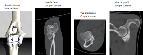 schéma répartition du passage des forces