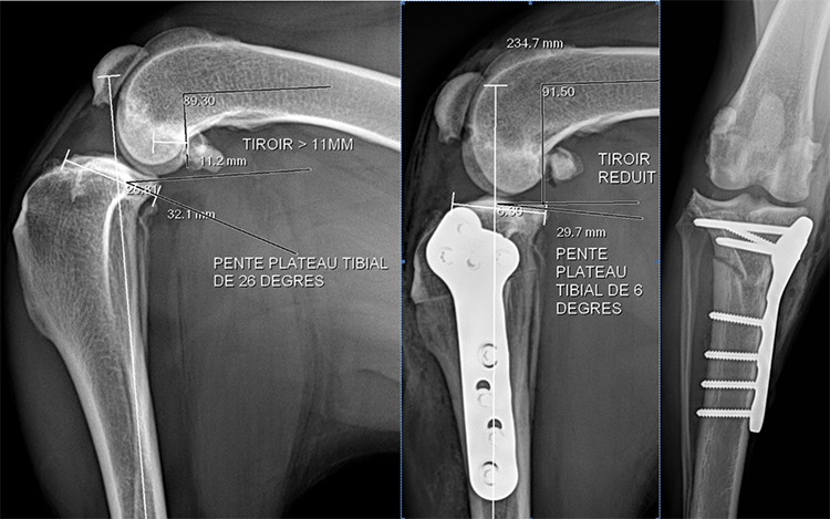 Rupture de ligament croisé crânial chez un chien de grande race - Clinique du Vernet